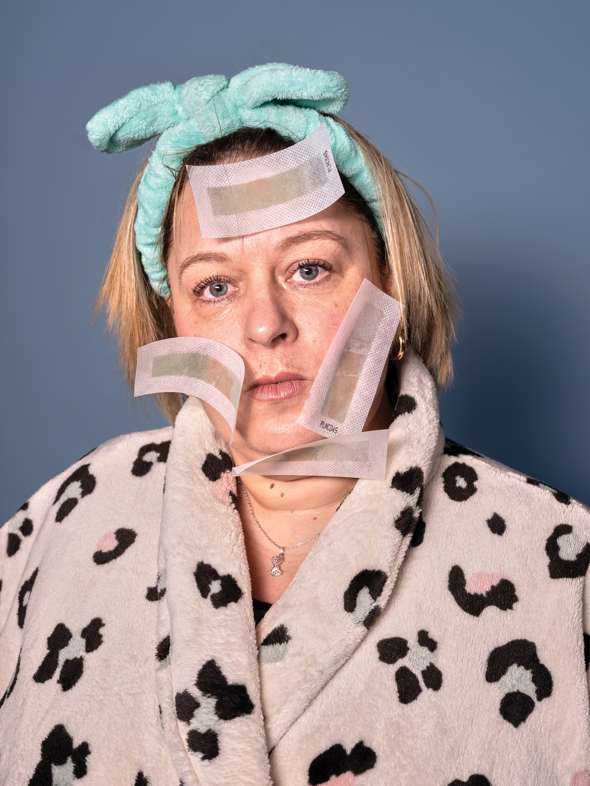A photo of a middle-aged woman in a black and cream spotted dressing gown with a blue headband in her hair and waxing strips stuck to her face
